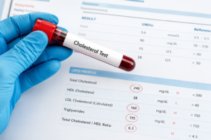 cholesterol test cost in Bangalore
